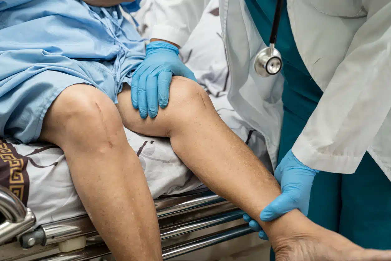 Arthroscopic Knee Surgery